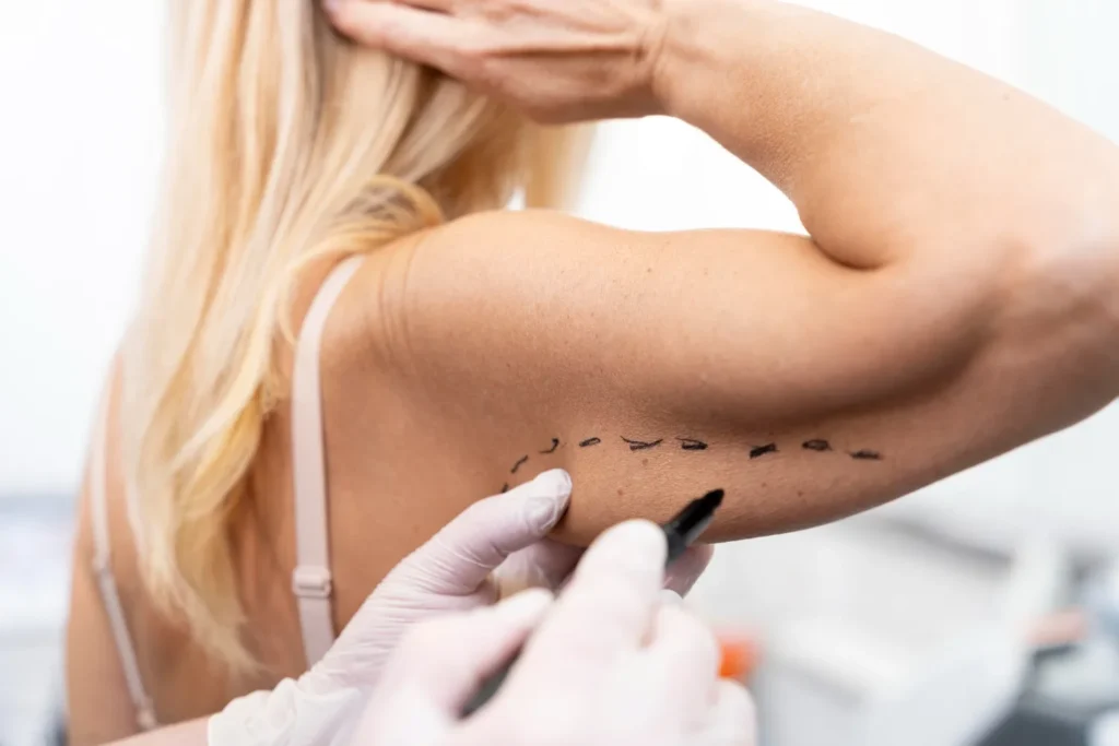 Woman getting plastic surgery reversal after failed lipo