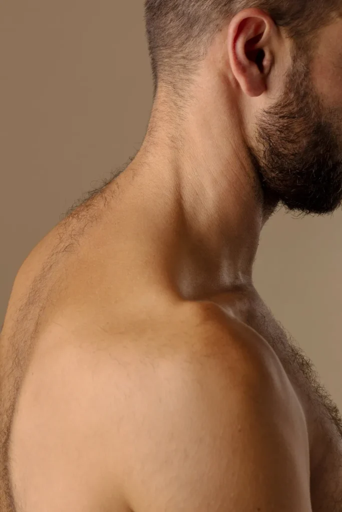 Side profile view of neck and jawline showing treatment area for neck plastic surgery procedures