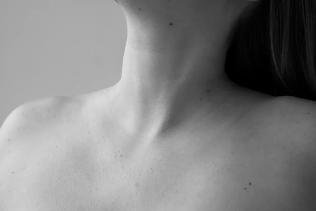 Black and white shot of a zoomed in neck of a woman after liposuction