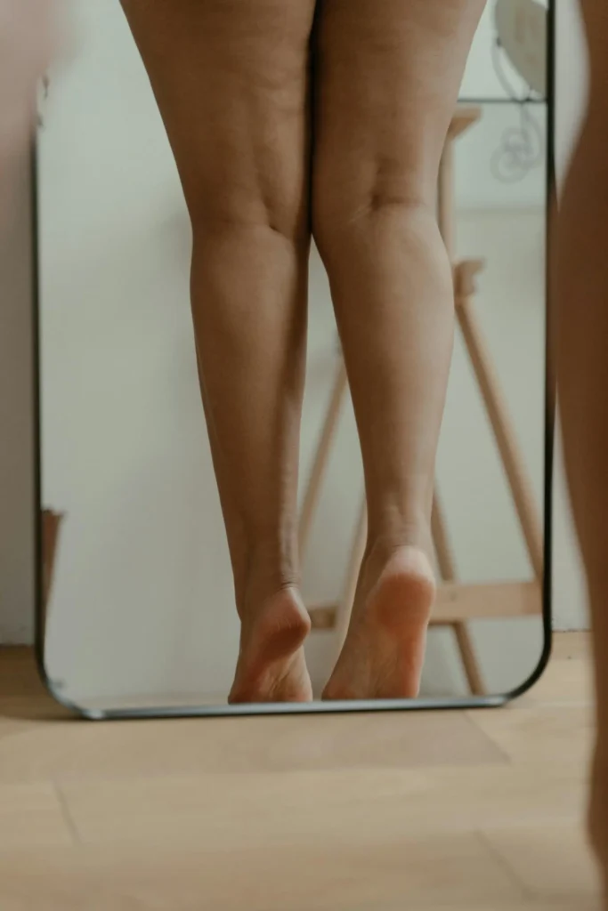 A woman having a problem with fatty thighs
