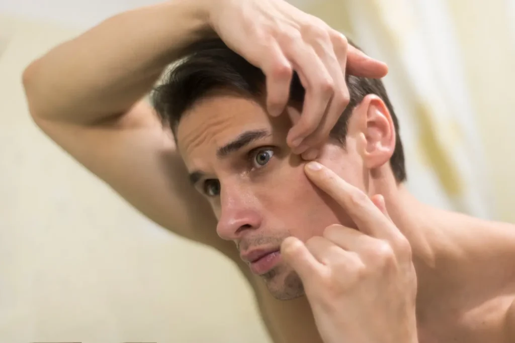 Man closely inspecting wrinkles and skin laxity around his eye area before FaceTite radiofrequency treatment
