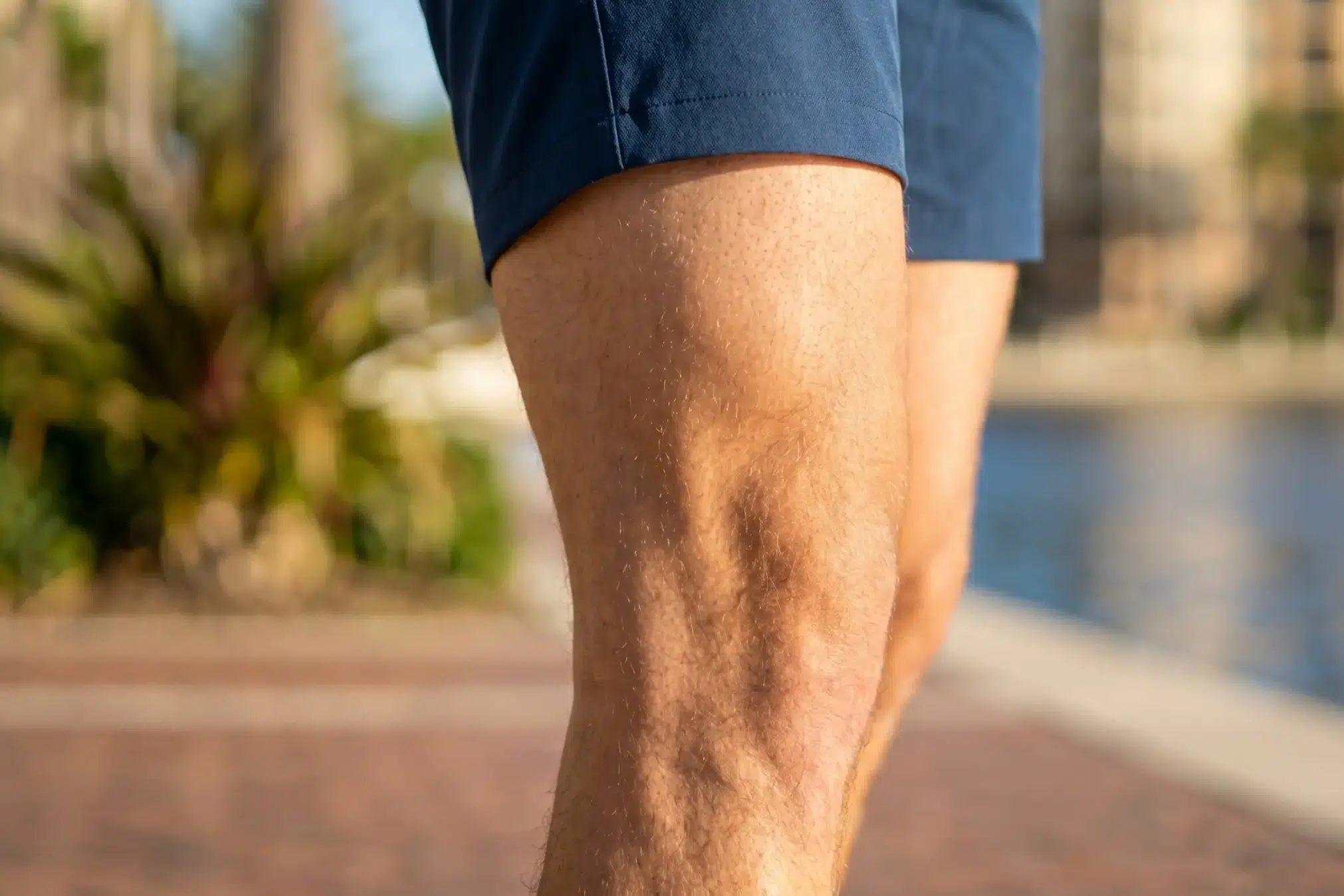 Close-up of a man's thighs in shorts walking outdoors.