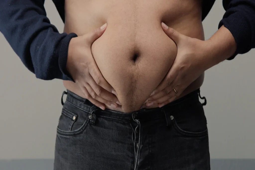 Overweight man closeup of belly front view put up shirt and pinch