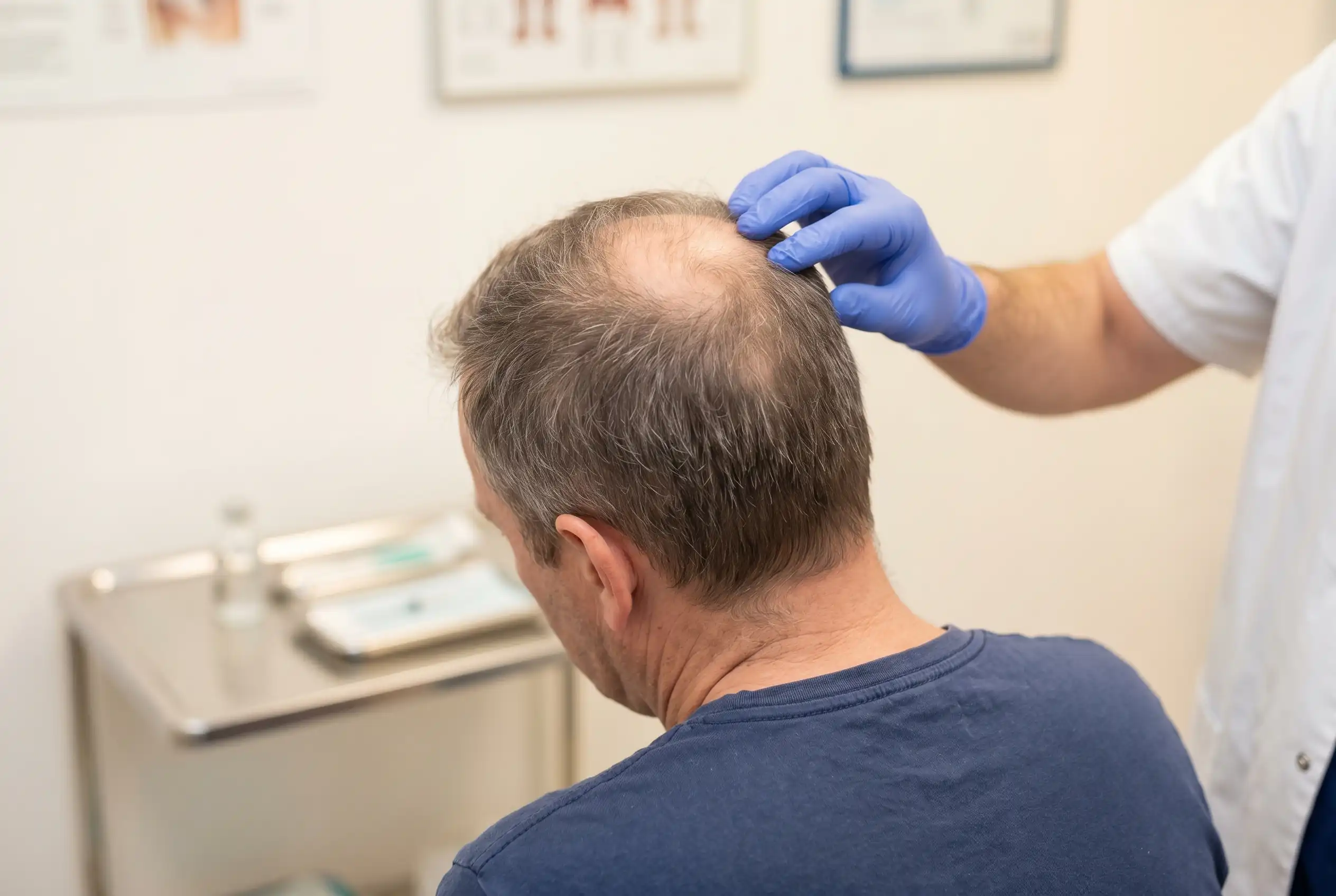 ipamorelin hair loss Ipamorelin & Sermorelin Peptide Blend for Muscle Growth main image 1