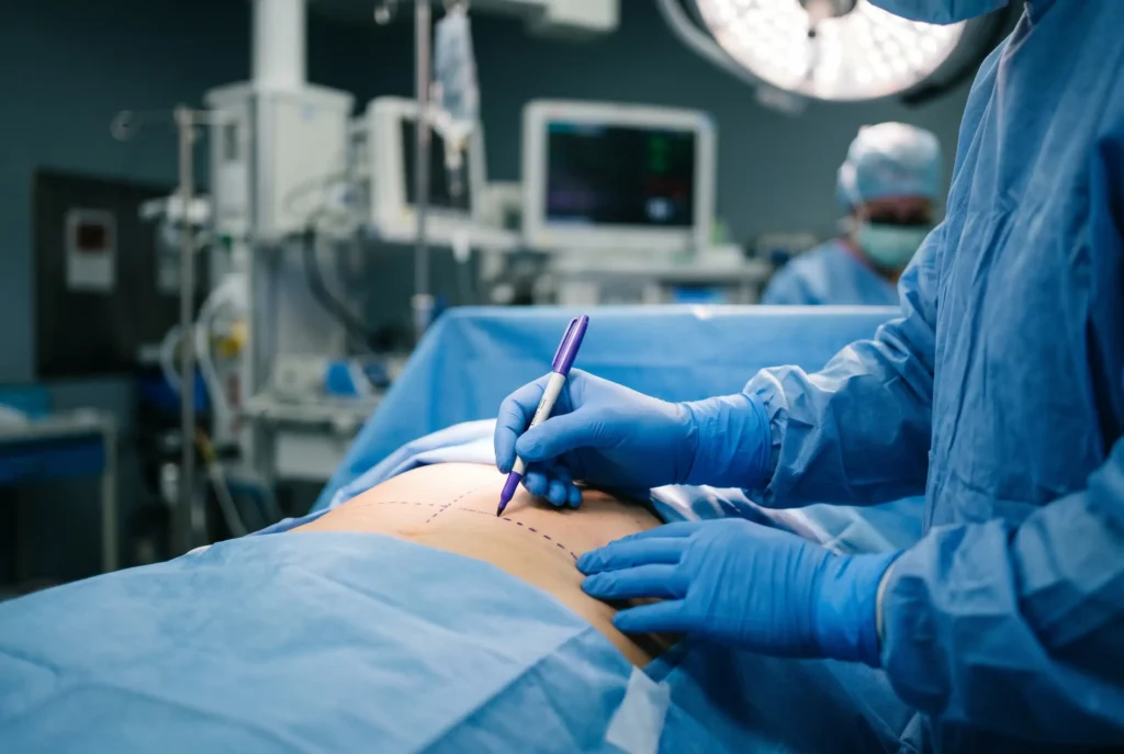 Pre-op marking before plastic surgery to reduce botched outcome risk