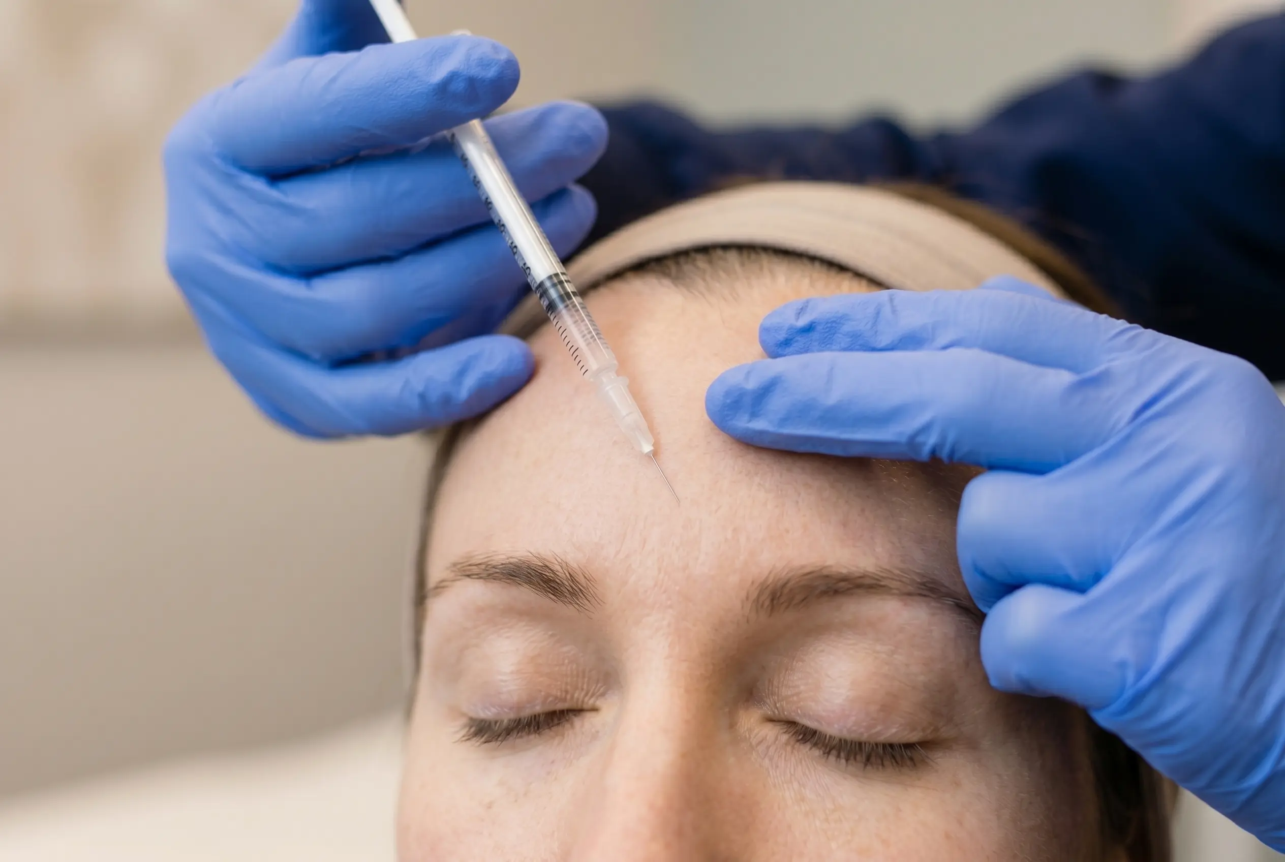 Close-up of a baby Botox micro-injection in a patient's forehead at a clinic