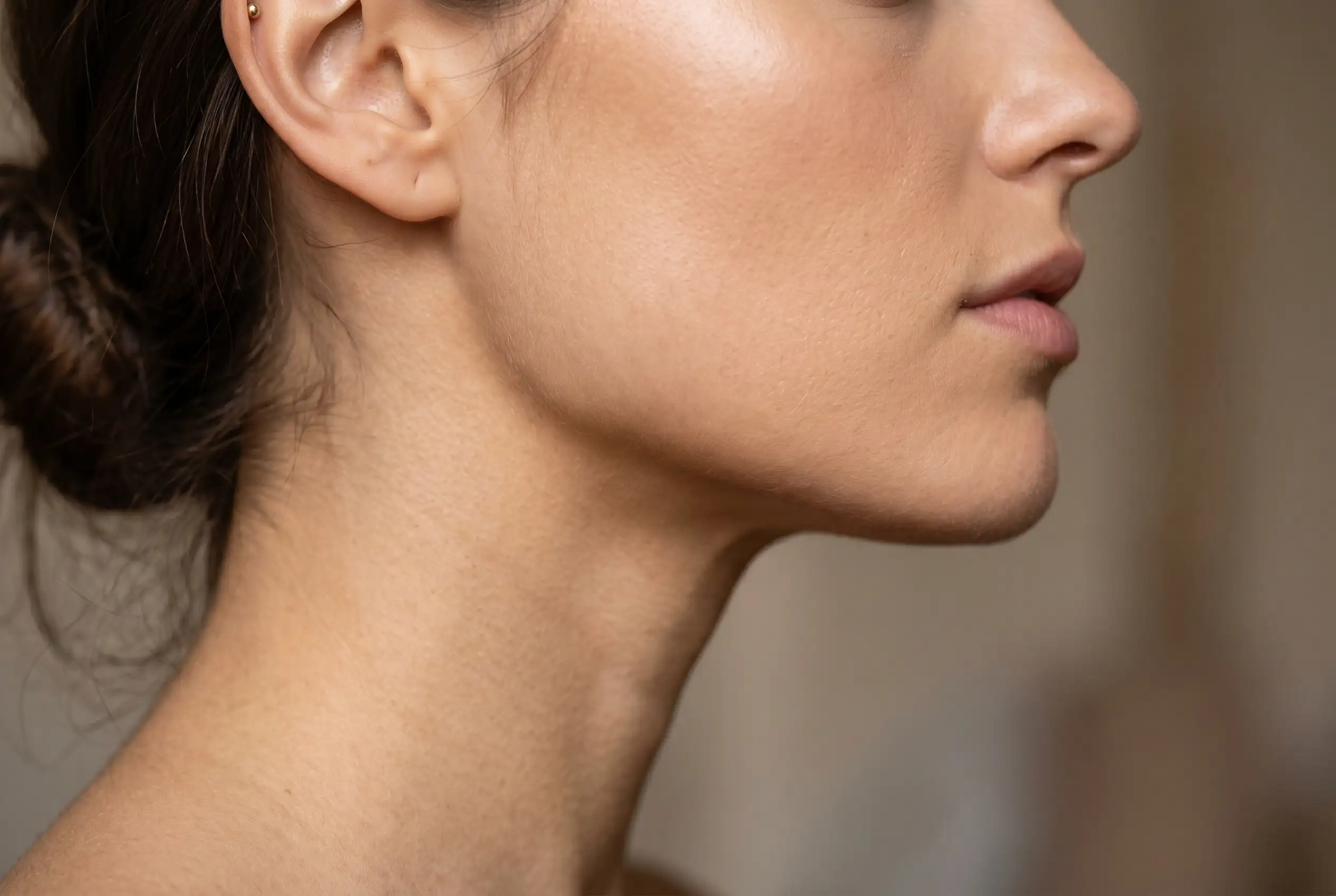Close-up profile of a defined jawline after a PDO thread lift