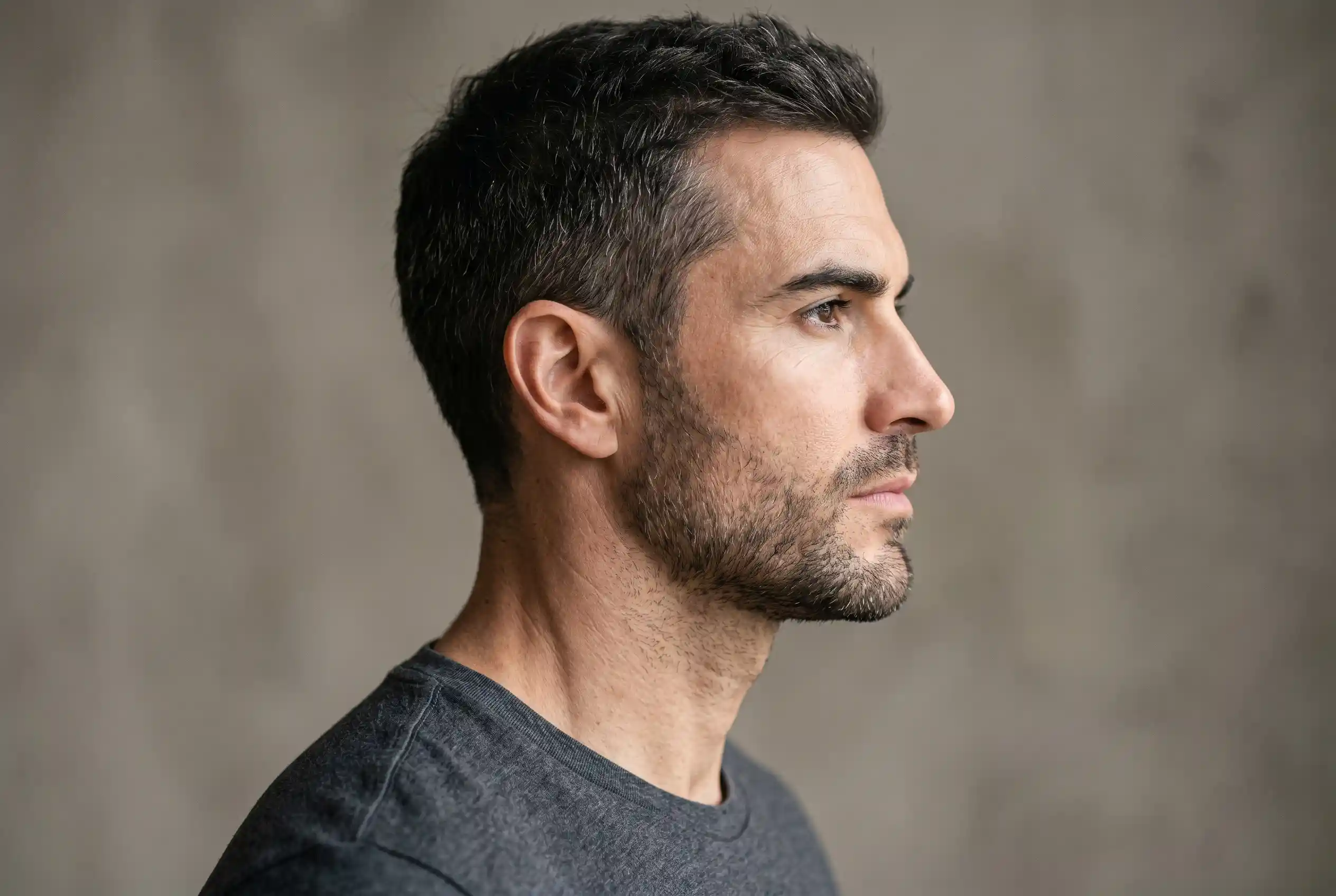 Side profile of a man with a defined chin and jawline after neck liposuction with chin augmentation