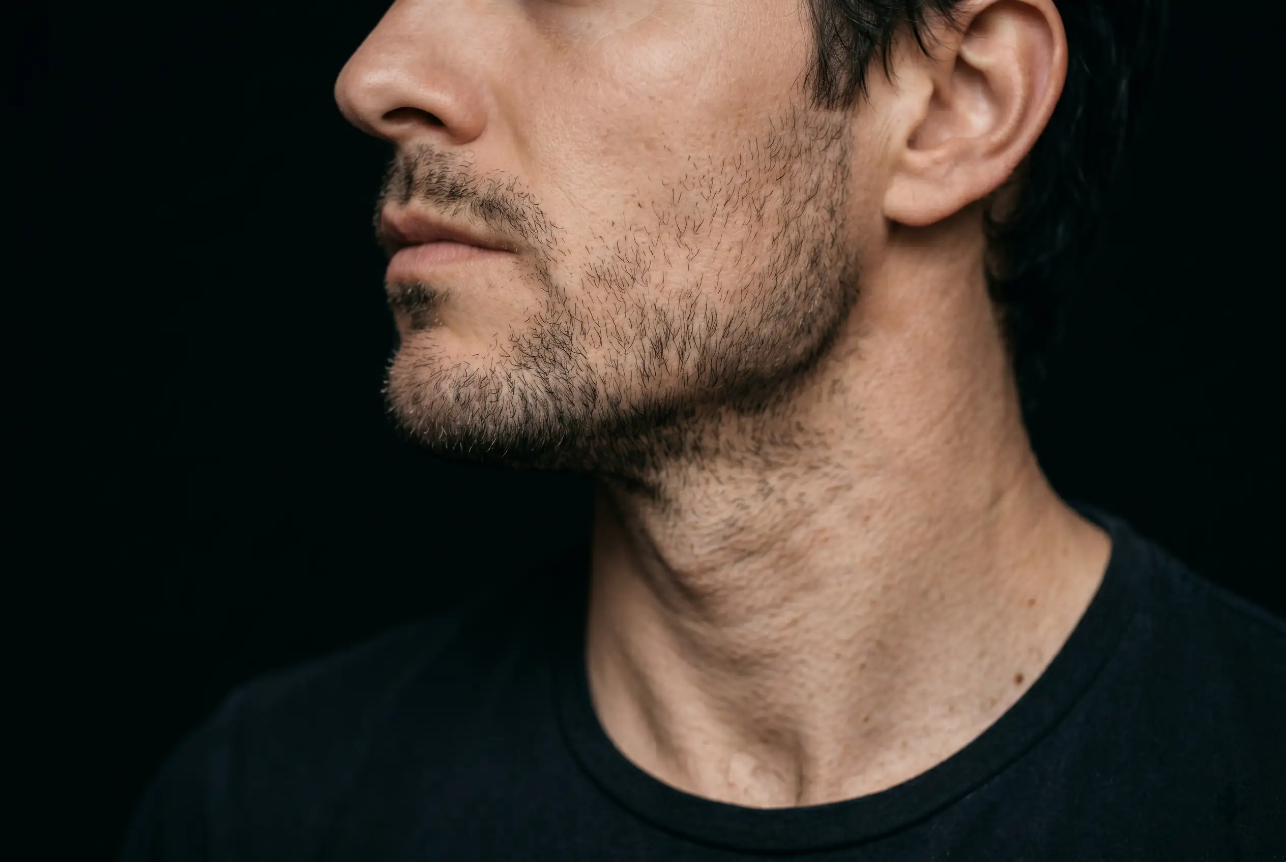 Detail of a contoured chin and jaw angle from jawline filler