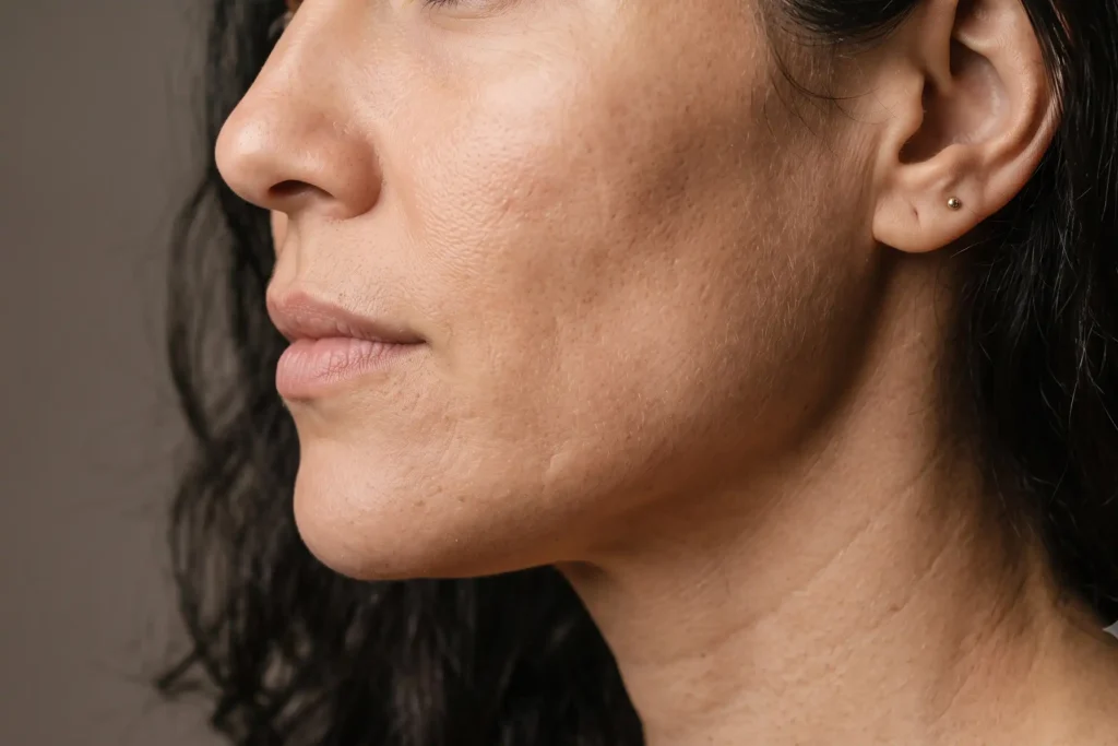 Close-up jaw profile relevant to masseter Botox slimming