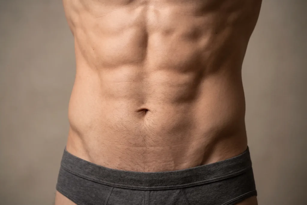 Long-term HD liposuction male ab results five years after surgery