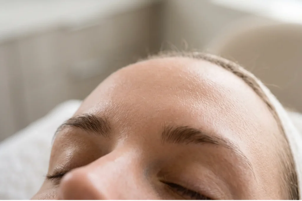 Smooth forehead after Botox in a Tampa aesthetic clinic