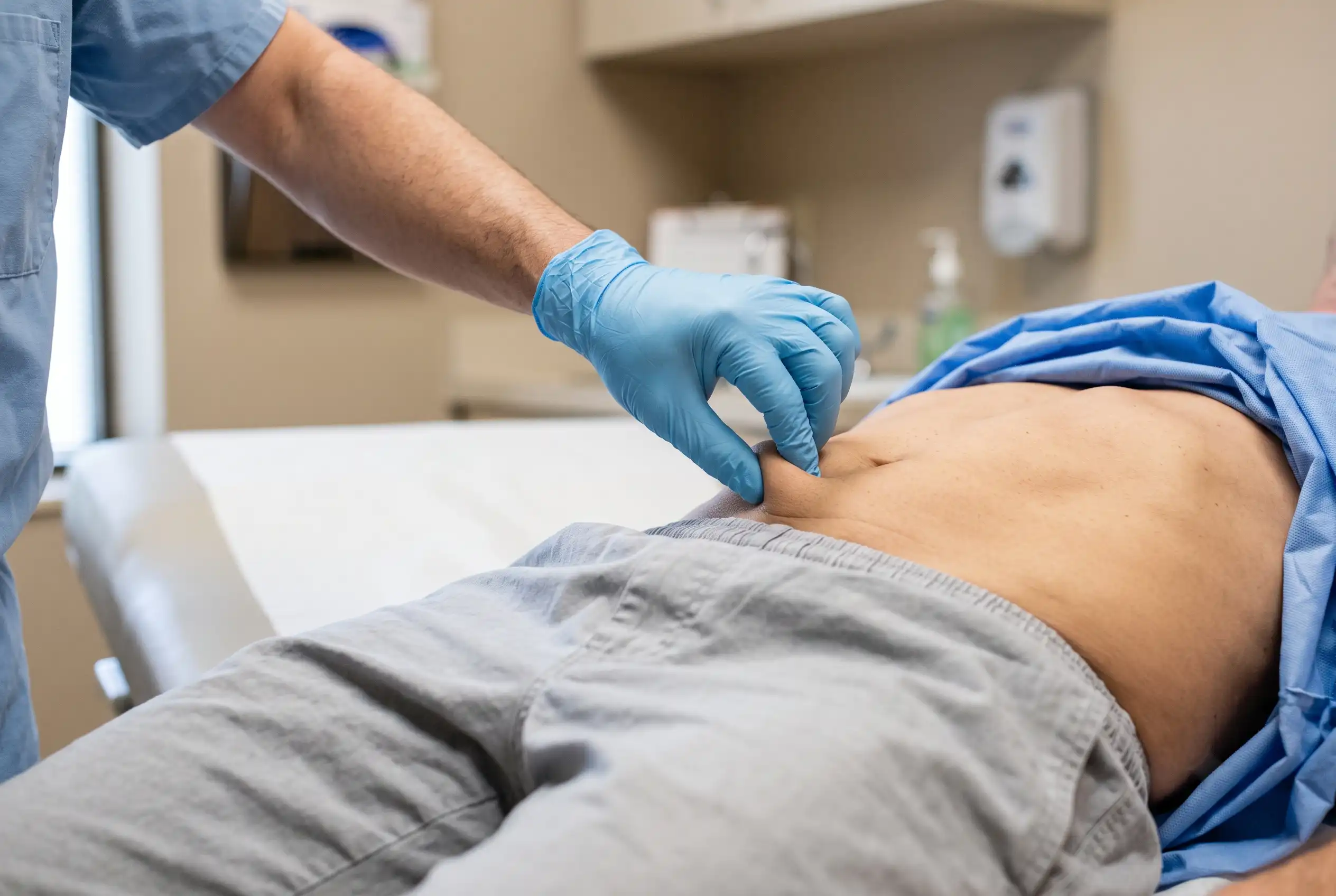 Surgeon performing a skin pinch test to assess elasticity before liposuction in Tampa