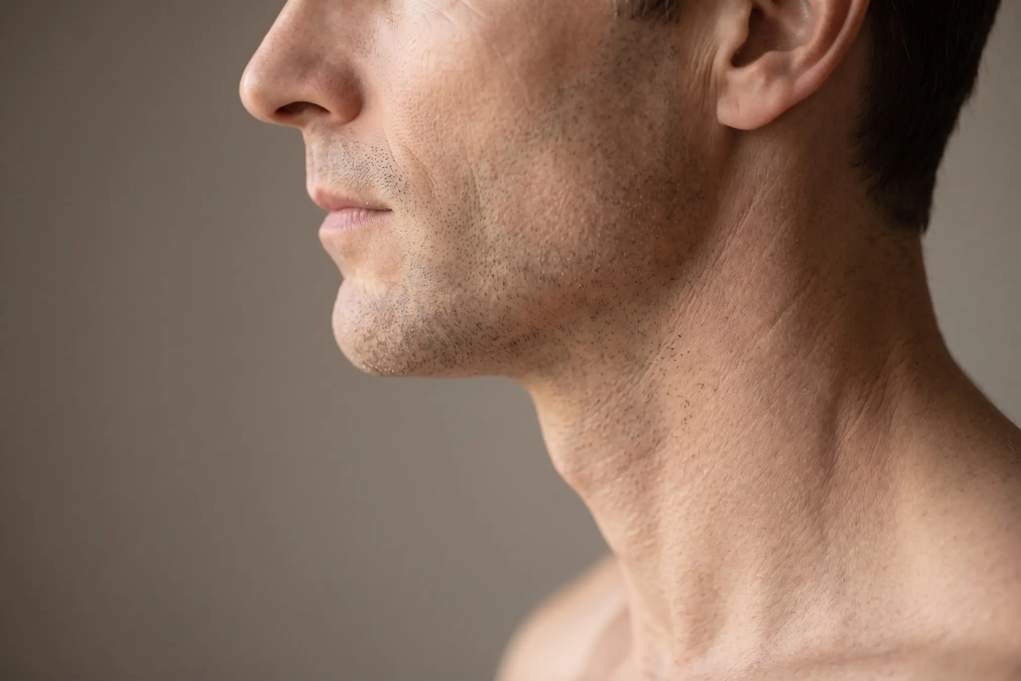 Defined jawline profile representing lasting neck liposuction results