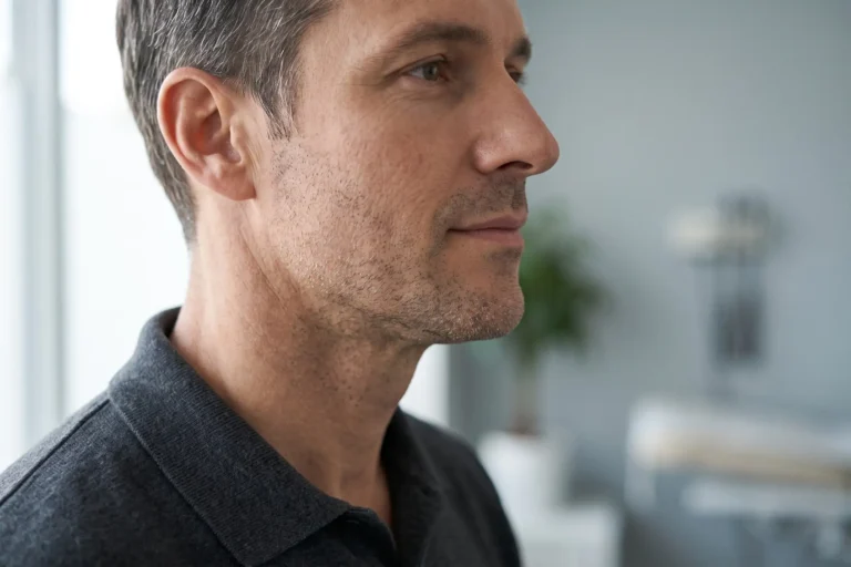 PDO thread lift jawline definition at Formation Tampa for Town 'n' Country patients