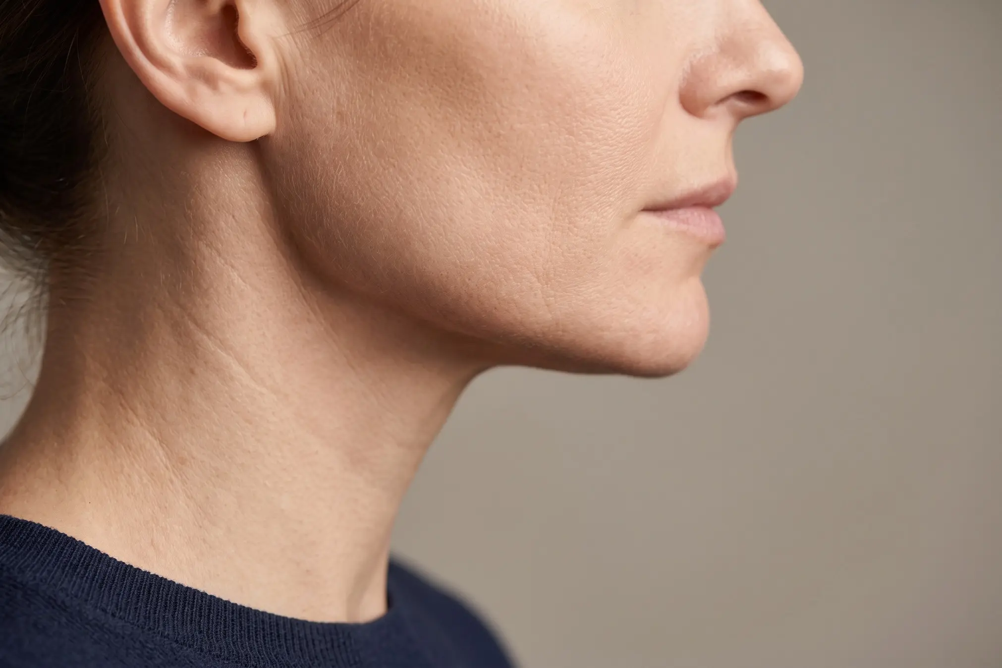 PDO threads over old threads, defined jawline on an adult in soft daylight