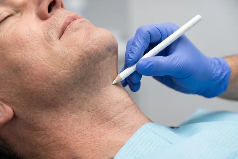 Provider marking jawline treatment zones before a combined injectable session