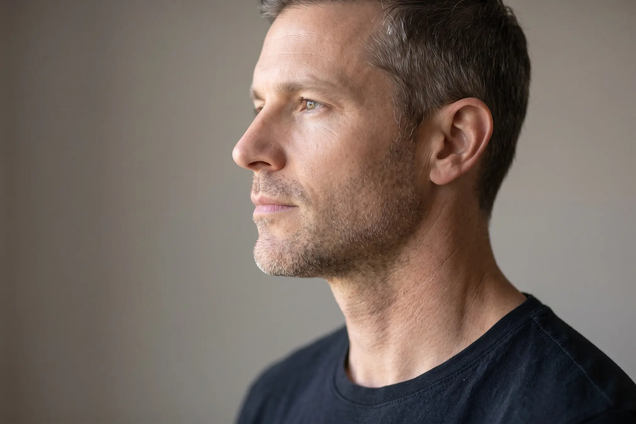 FaceTite and skin quality shown by a firm neck and defined jawline in profile