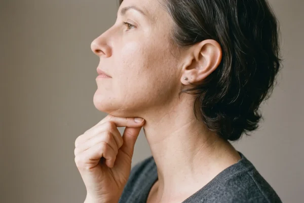 Pinch test under the chin to tell submental fat from loose skin before neck liposuction