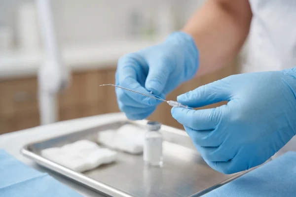 Close-up of a dissolvable PDO thread cannula before a non-surgical thread lift
