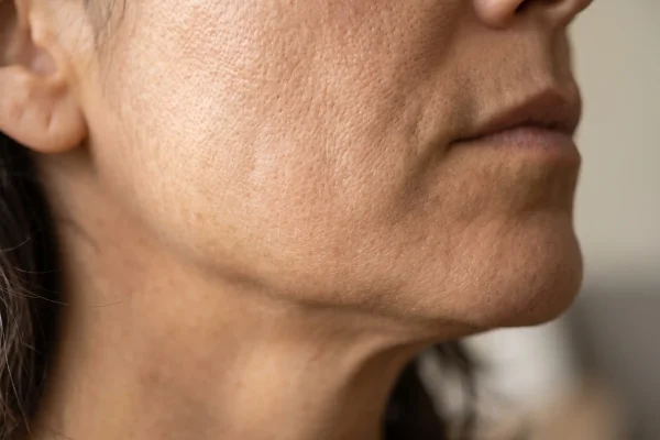Close-up of firm smooth skin supported by copper peptides