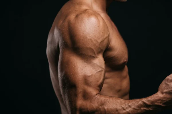 Defined male shoulder and arm after athletic liposuction sculpting