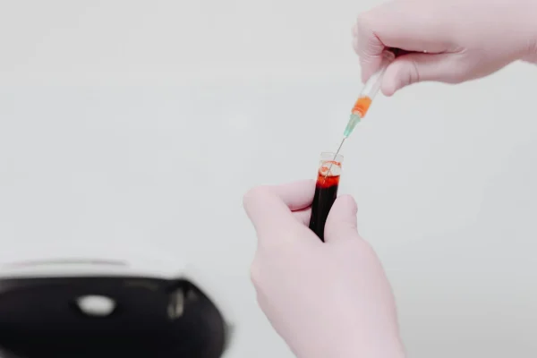Doctor preparing the PRP test kit
