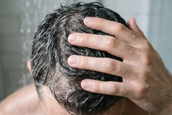 Fingertip washing technique for a tender scalp after PRP injections