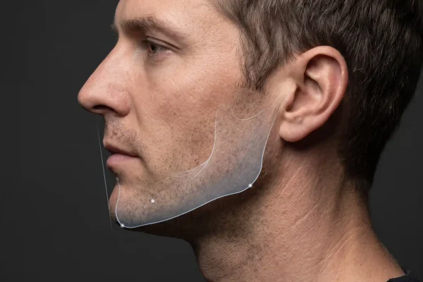 Profile view showing chin projection and jaw angle that determine jawline definition