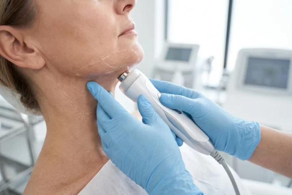 Radiofrequency device treating the jawline as a non-surgical jowl option