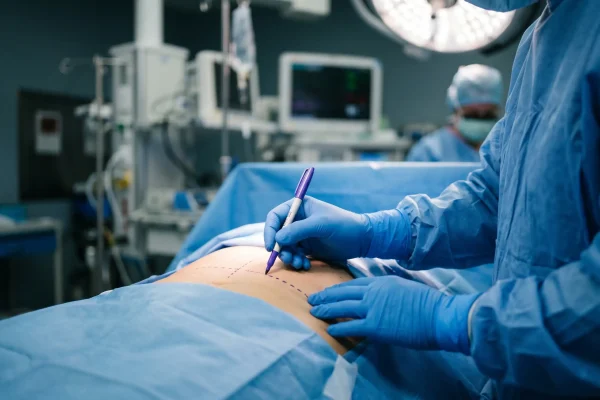 Pre-op marking before plastic surgery to reduce botched outcome risk