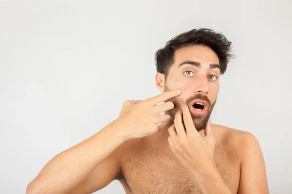 Man examining his cheek skin texture and firmness to assess PDO thread lift results for facial rejuvenation