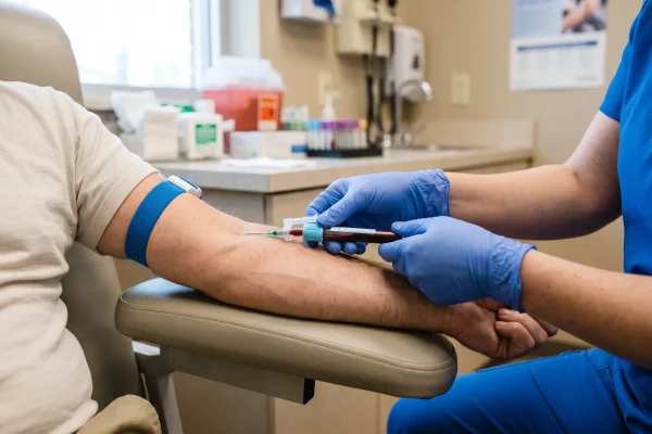 Blood draw from the arm for an autologous PRP hair treatment
