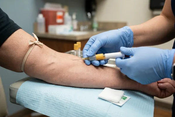 Bloodwork to monitor IGF-1 levels during safe Sermorelin treatment