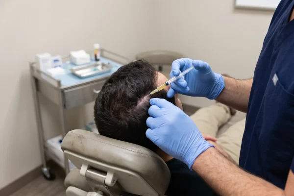 Clinician injecting PRP into a patient's scalp during hair restoration