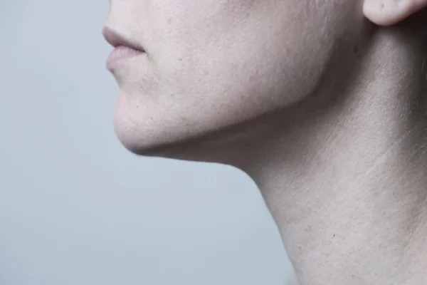 Close-up of a defined mandibular border showing what jaw filler builds