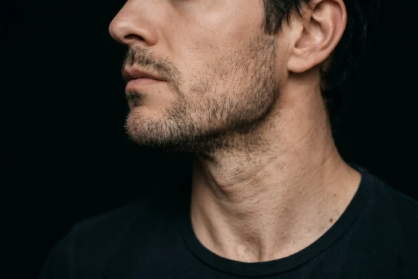 Detail of a contoured chin and jaw angle from jawline filler