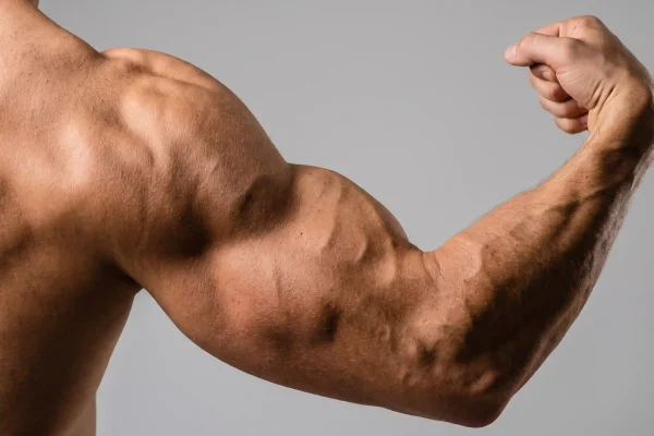Upper arm muscle groups targeted by high-definition arm liposuction