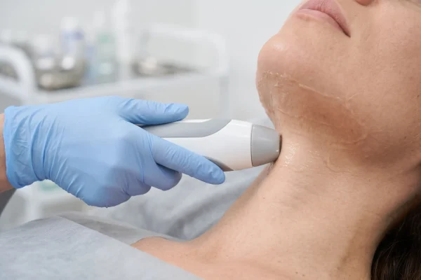 In-office energy treatment tightening neck skin without surgery.