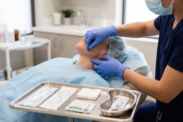 In-office PDO thread placement showing the quick, minimally invasive repeat treatment