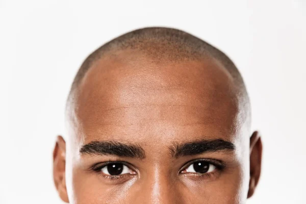 man's forehead