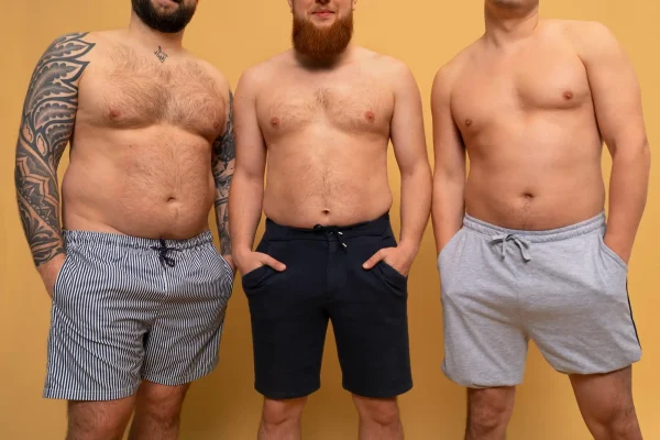 men candidates for Tummy Tuck