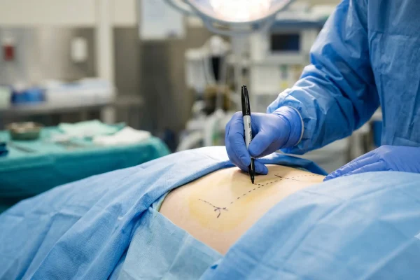 More healing sites raise the risk of having multiple plastic surgeries at once
