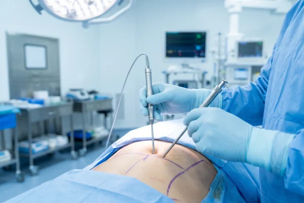 Plastic surgeon holding HD liposuction cannula and VASER ultrasound device