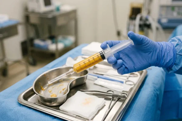Purified fat prepared for transfer during high-definition liposuction