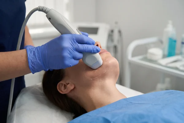 Radiofrequency skin tightening pass along the jaw during facial contouring treatment