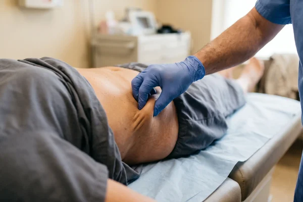 Skin elasticity pinch test, a key factor in liposuction recovery