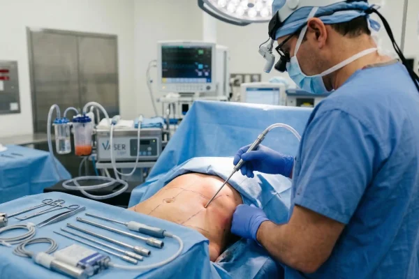 surgeon doing lipo