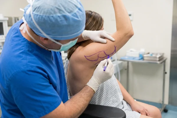 Surgeon marking contour lines on an upper arm before arm liposuction in Tampa