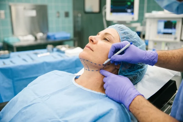 Surgeon marking jaw and neck planning lines before neck contouring surgery in Tampa